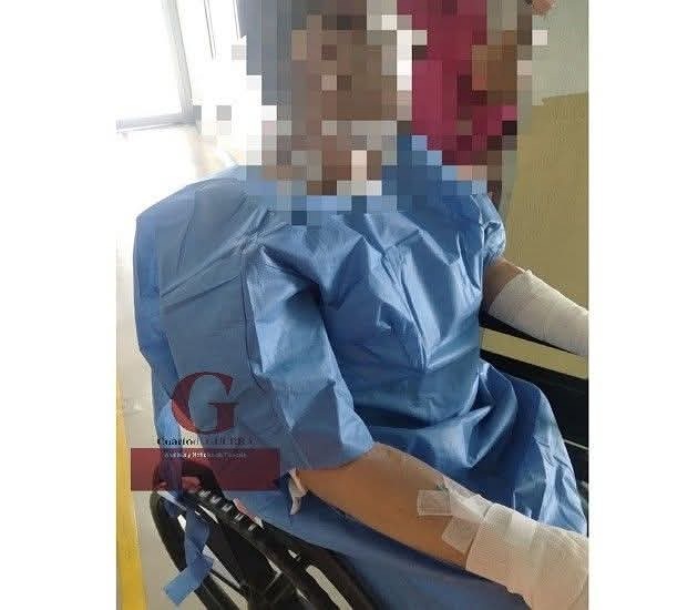 Hombre sufre quemaduras por flamazo de gas en Terrenate