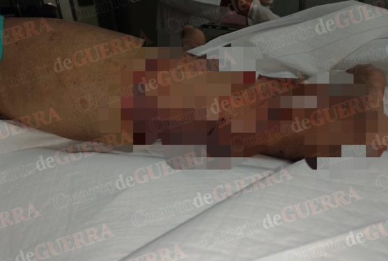 Peligro en las calles: los perros sueltos y la falta de control