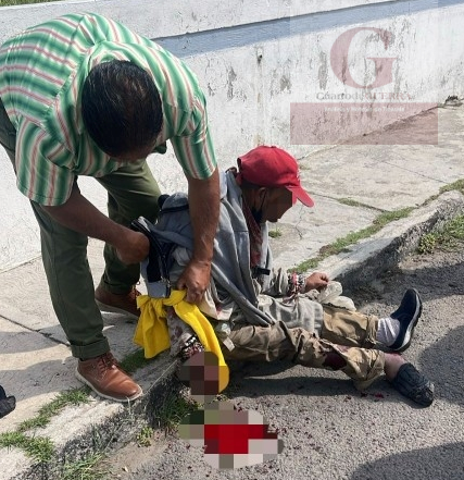Unidad de USU atropella a recolector de PET en Tlaxcala; la víctima podría perder un dedo